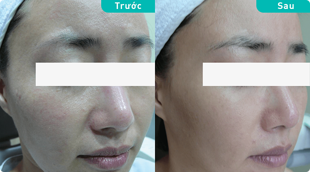 Patient testimonial