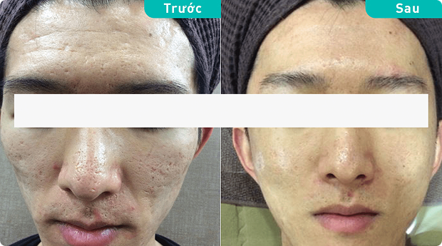 Patient testimonial