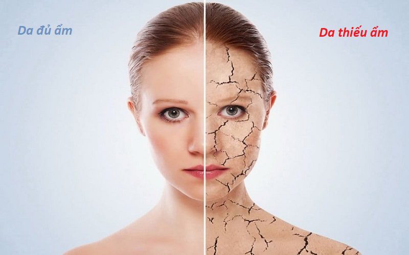 Tầm quan trọng của việc dưỡng ẩm da mỗi ngày