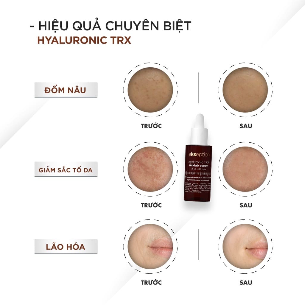 hiệu quả ekseption trx