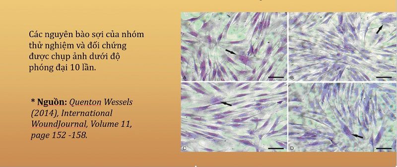 Niacinamide tăng sinh nguyên bào sợi, kích thích lành thương, mờ sẹo