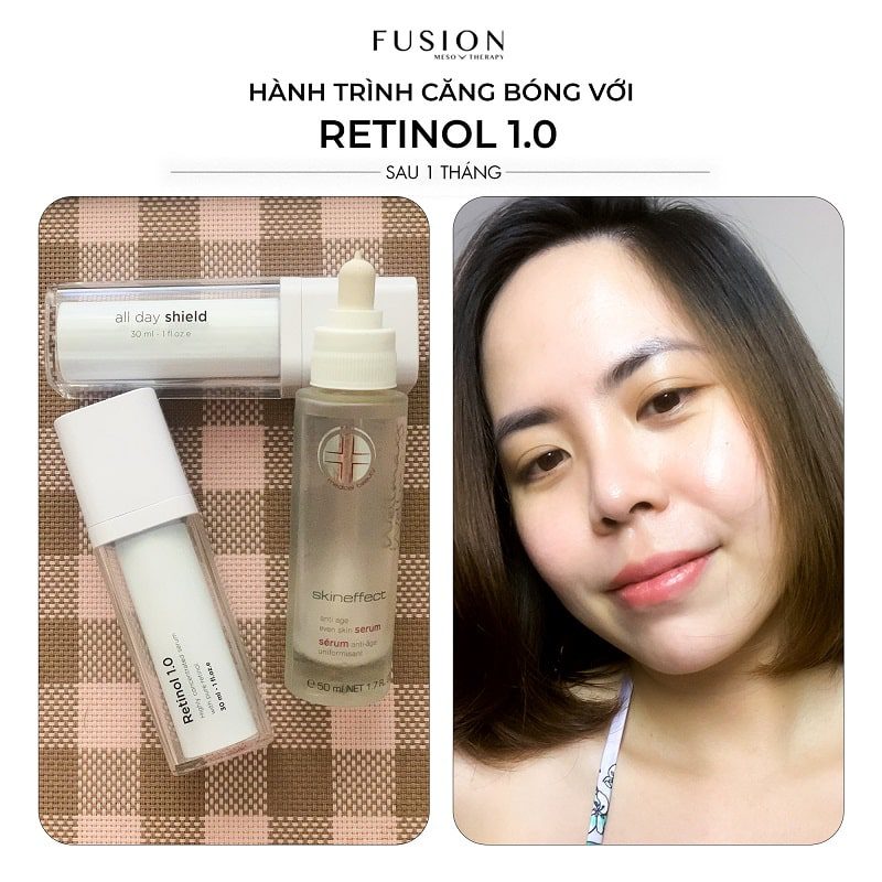 Chống lão hóa tối ưu với Retinol và serum skineffect