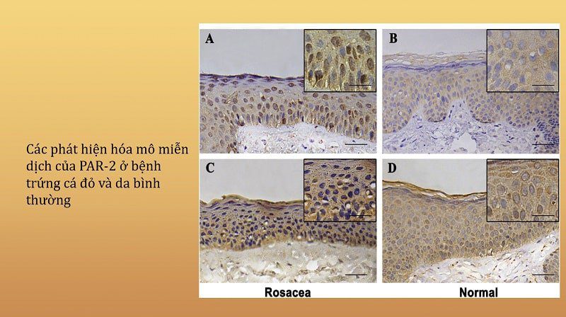 so sánh hiệu quả của hydroquinon