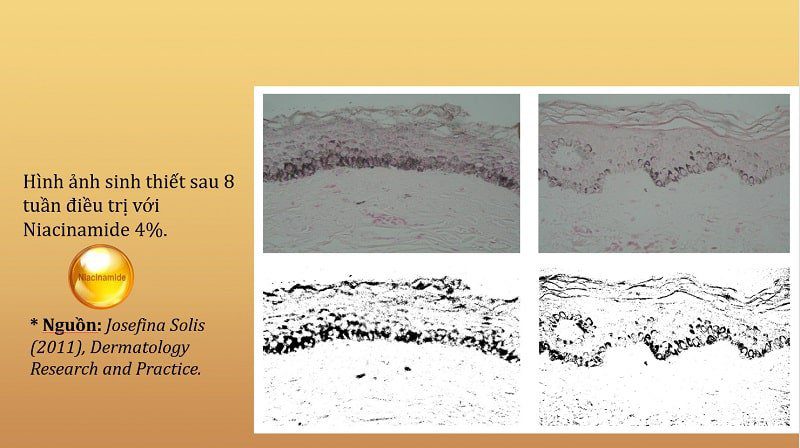 So sánh hiệu quả trị nám Niacinamide và Hydroquione - 3