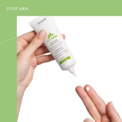 chất gel chấm mụn spot controll