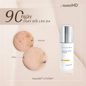 kem trị nám nanomd cyntra