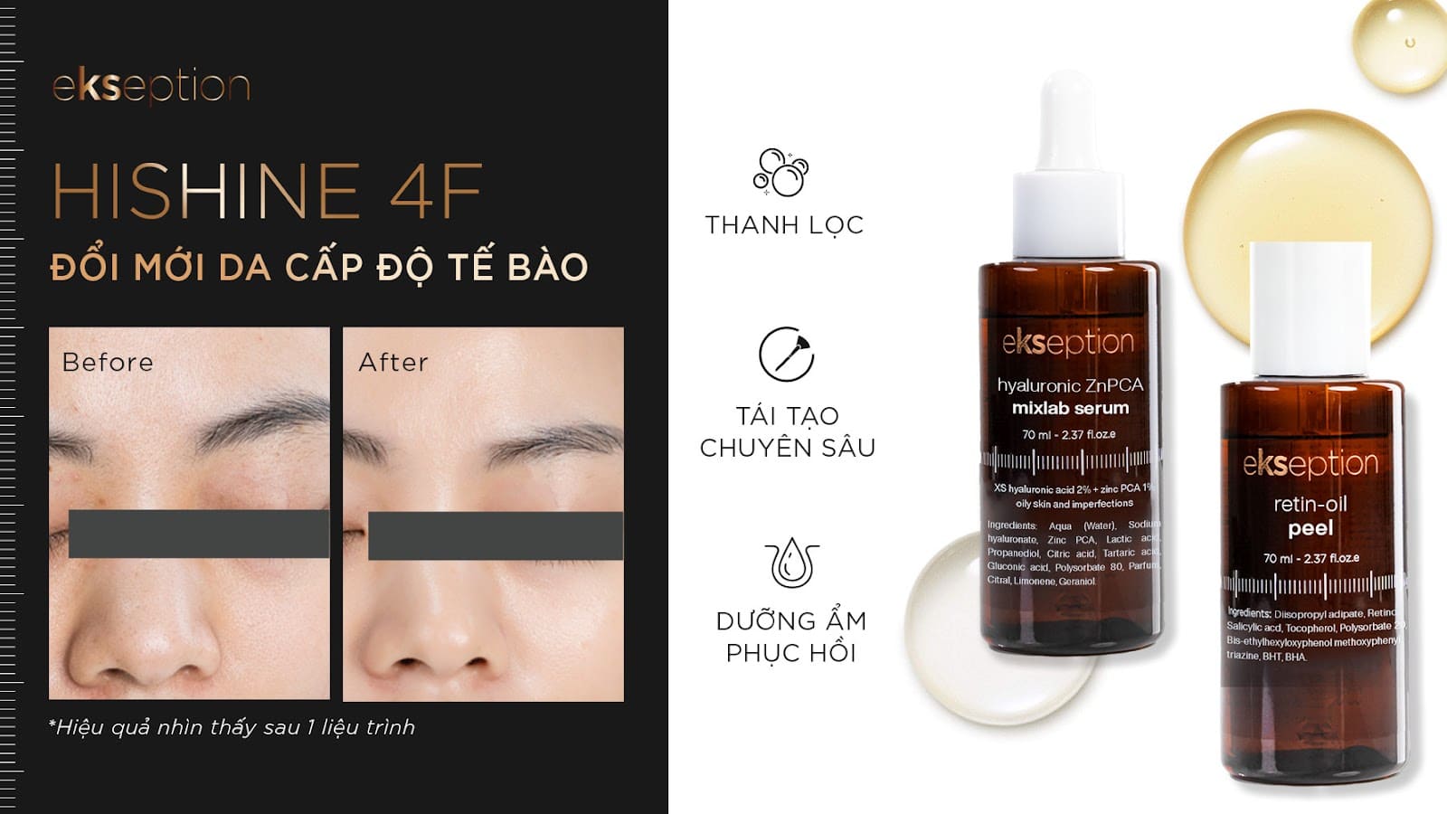 Liệu trình căng bóng da HISHINE 4F – Đổi mới da cấp độ tế bào