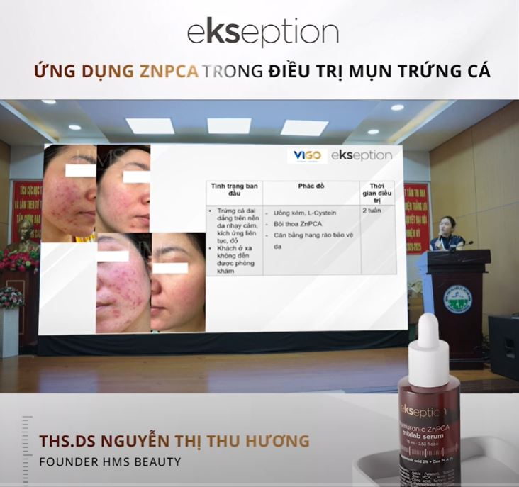 Ths.Ds Nguyễn Thị Thu Hương – Ứng dụng Hyaluronic ZnPCA Ekseption trong hội thảo khoa học