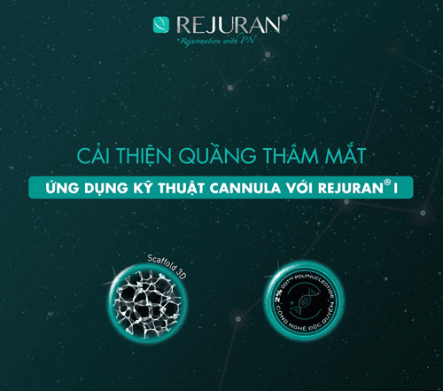 ????????????????????????????® ???? | CẢI THIỆN QUẦNG THÂM, NẾP NHĂN VÀ GIẢM SƯNG VÙNG MẮT BẰNG KỸ THUẬT CANNULA