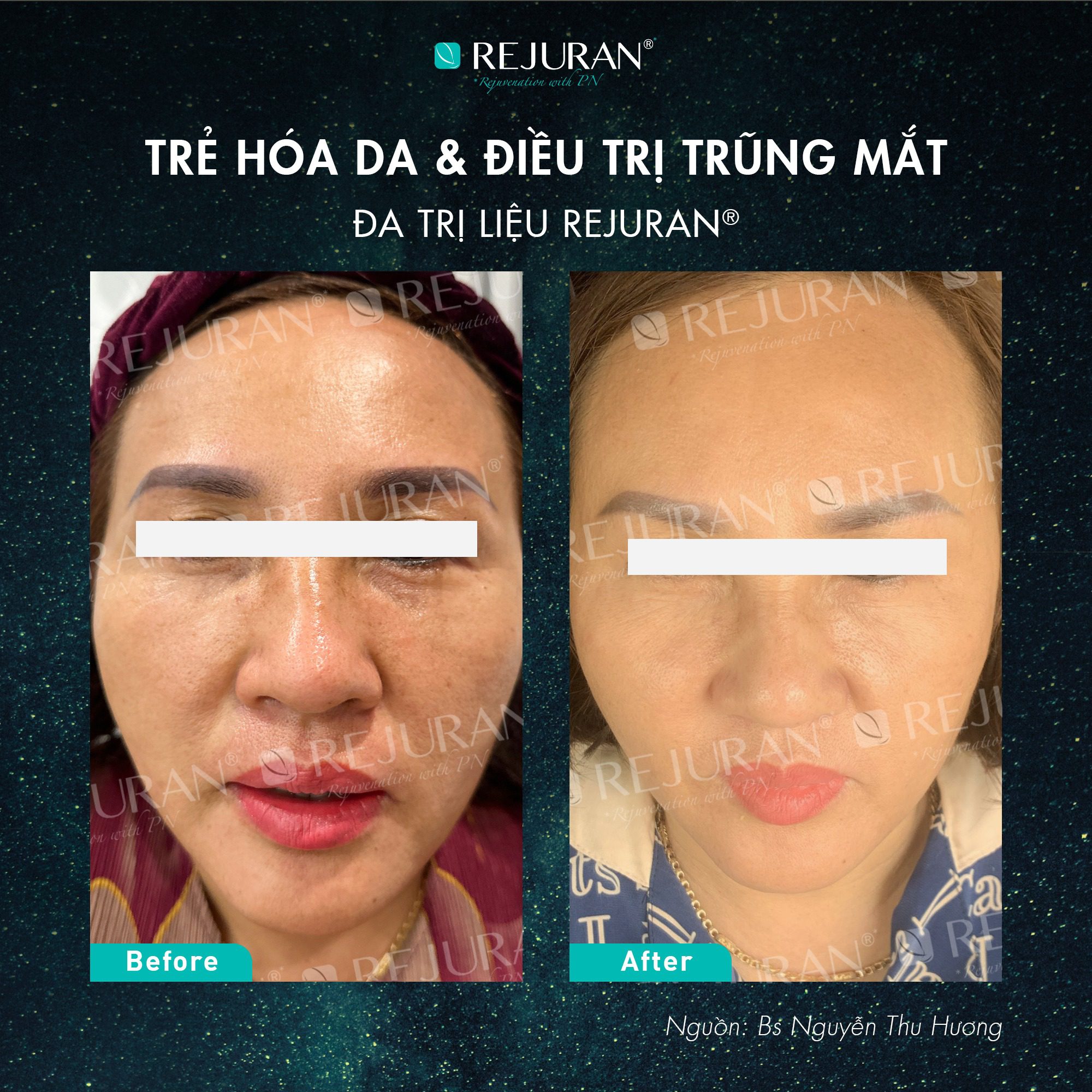 HIỂU ĐÚNG VỀ LÃO HOÁ VÀ CÁCH ỨNG DỤNG REJURAN® CÙNG BS CKI TÔ LAN PHƯƠNG