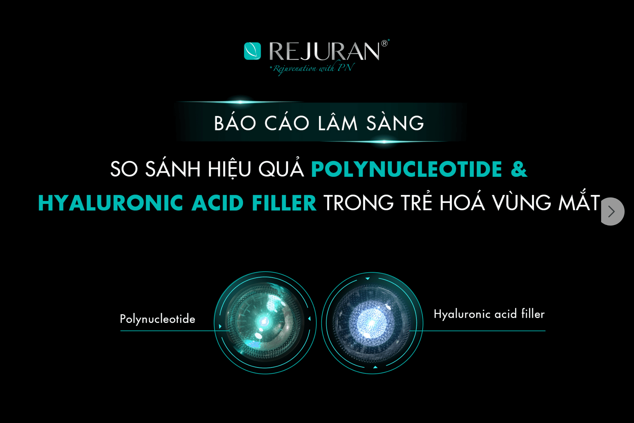 SO SÁNH HIỆU QUẢ POLYNUCLEOTIDE & HYALURONIC ACID (FILLER) TRONG TRẺ HOÁ VÙNG MẮT